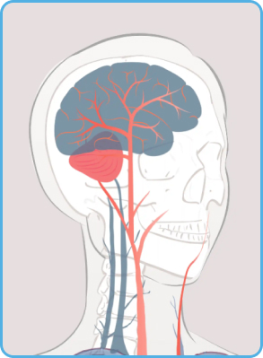 Neurovascular treatments